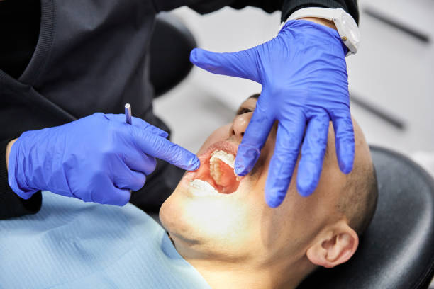 Best Teeth Whitening  in Lake Shore, MN
